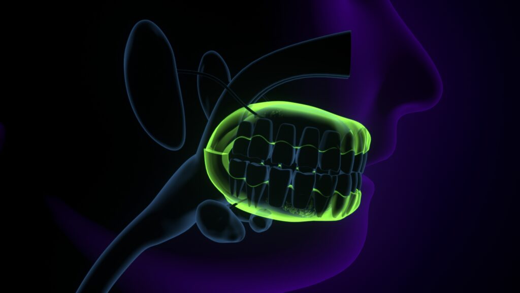 AI Gum Treatment in turkey