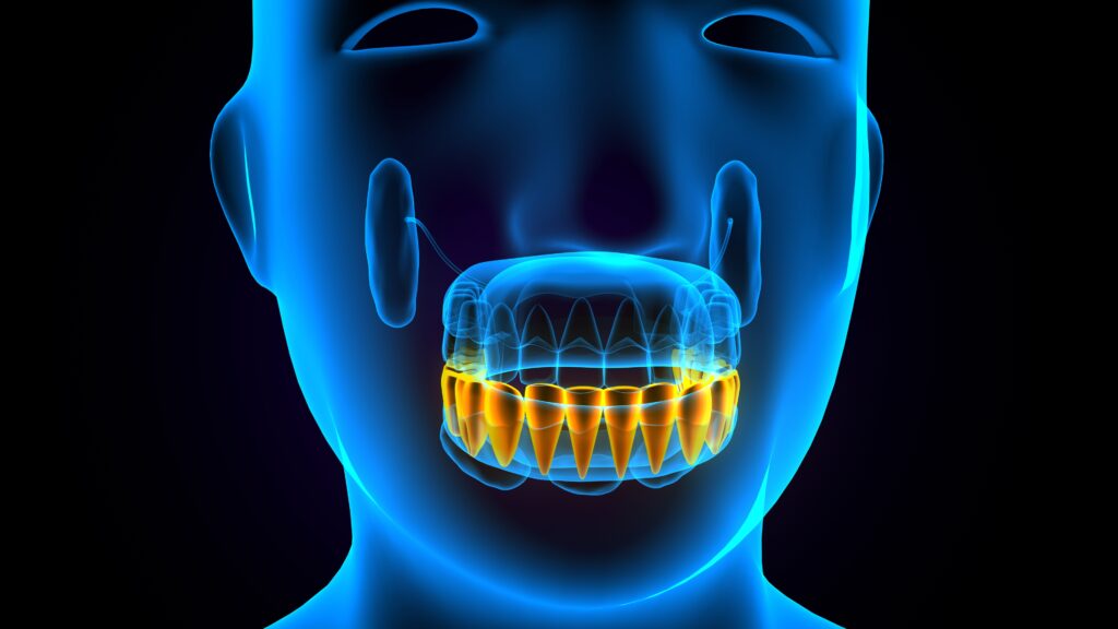 AI Gum Treatment clinic in turkey istanbul