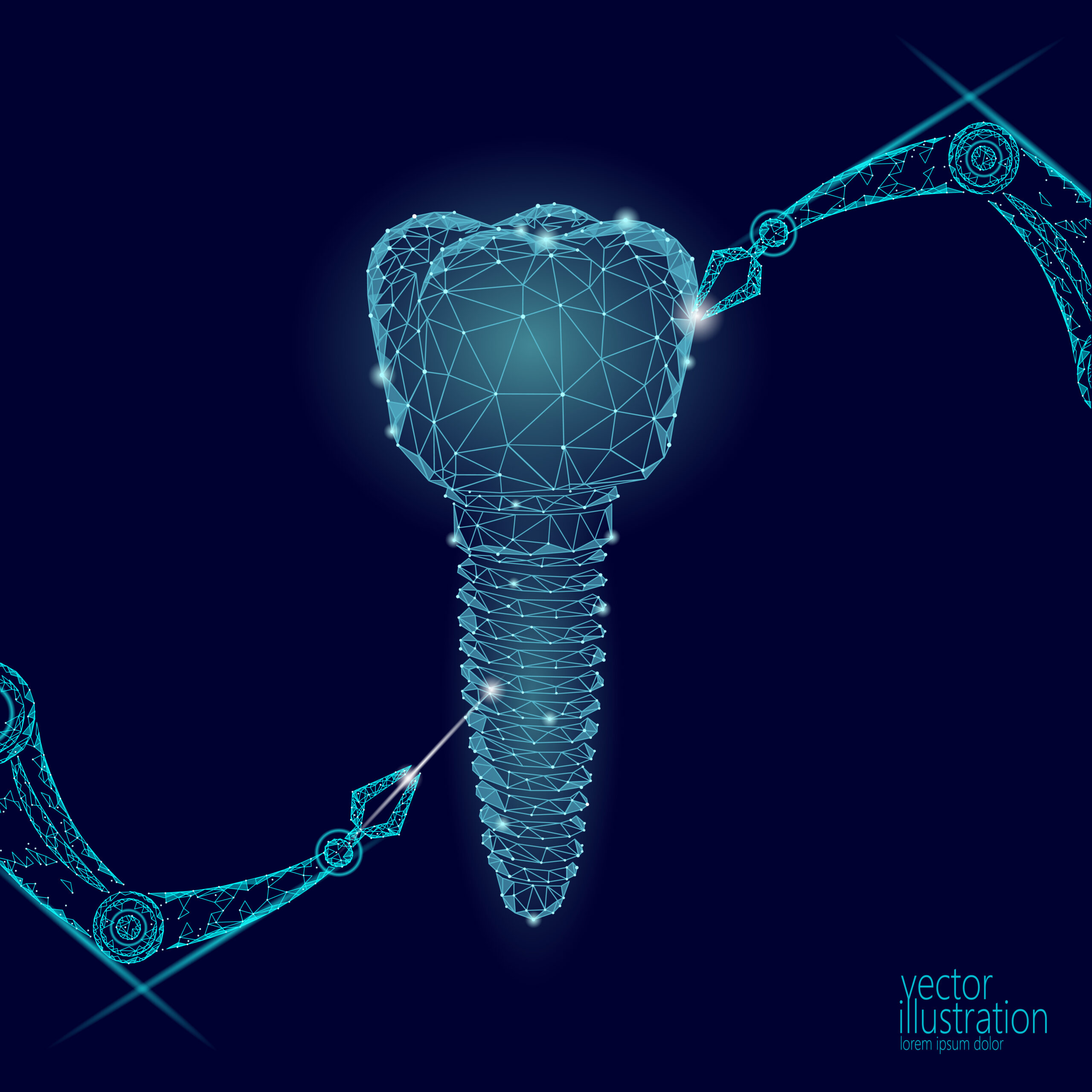 AI Dental Implants clinic in turkey